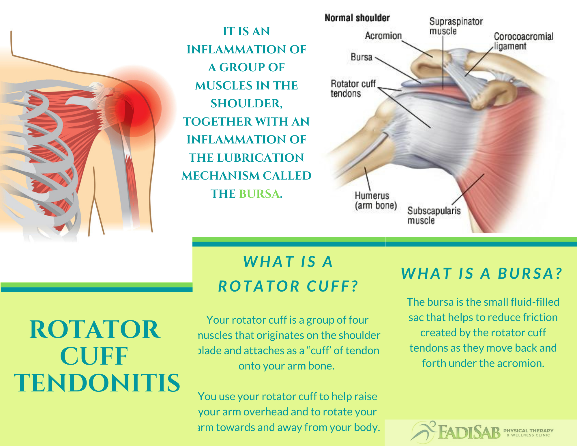 Pt For Rotator Cuff Tendinitis At Ada Tawney Blog
