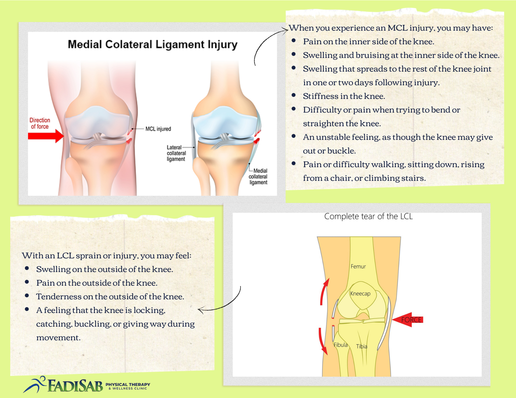 Collateral Ligamant Injuries and how they are treated at SSC